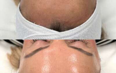 Medicina estética avanzada en Bogotá tendencias que están marcando 2026